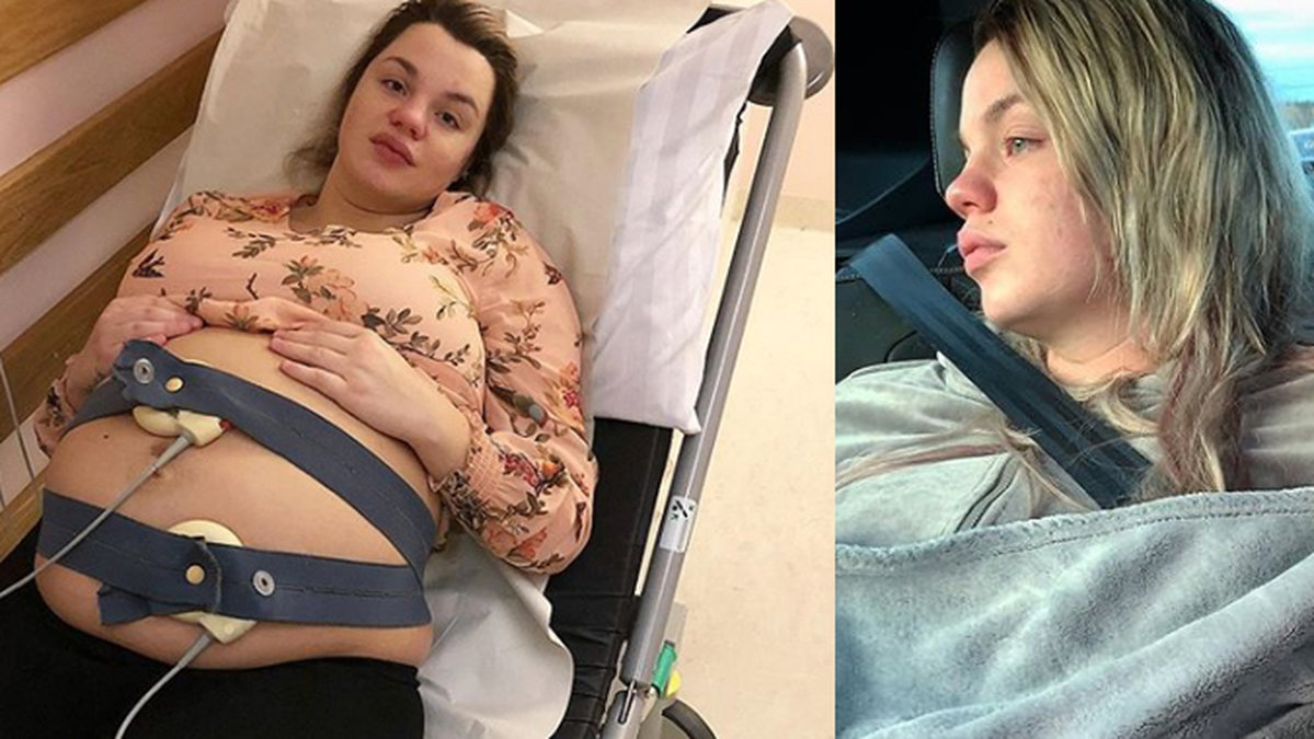 Jonna Lundell fick en förlossningspsykos