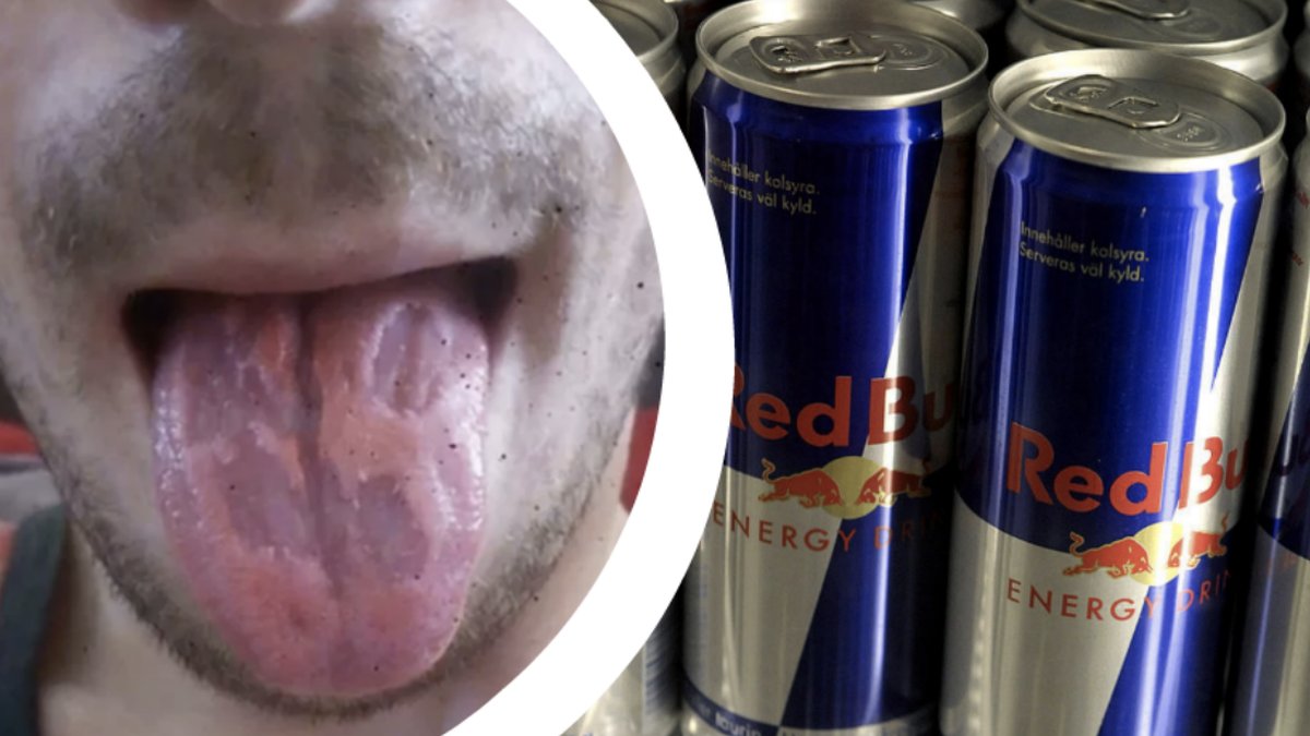 Tunga, Redbull
