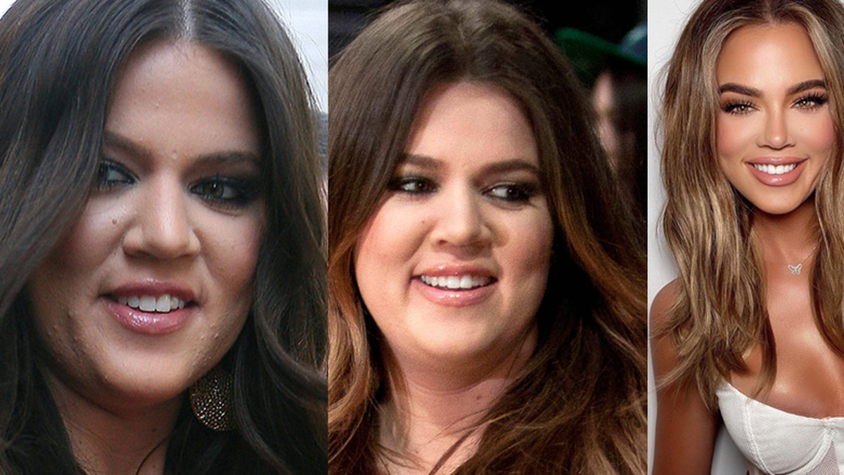 Khloe Kardashian