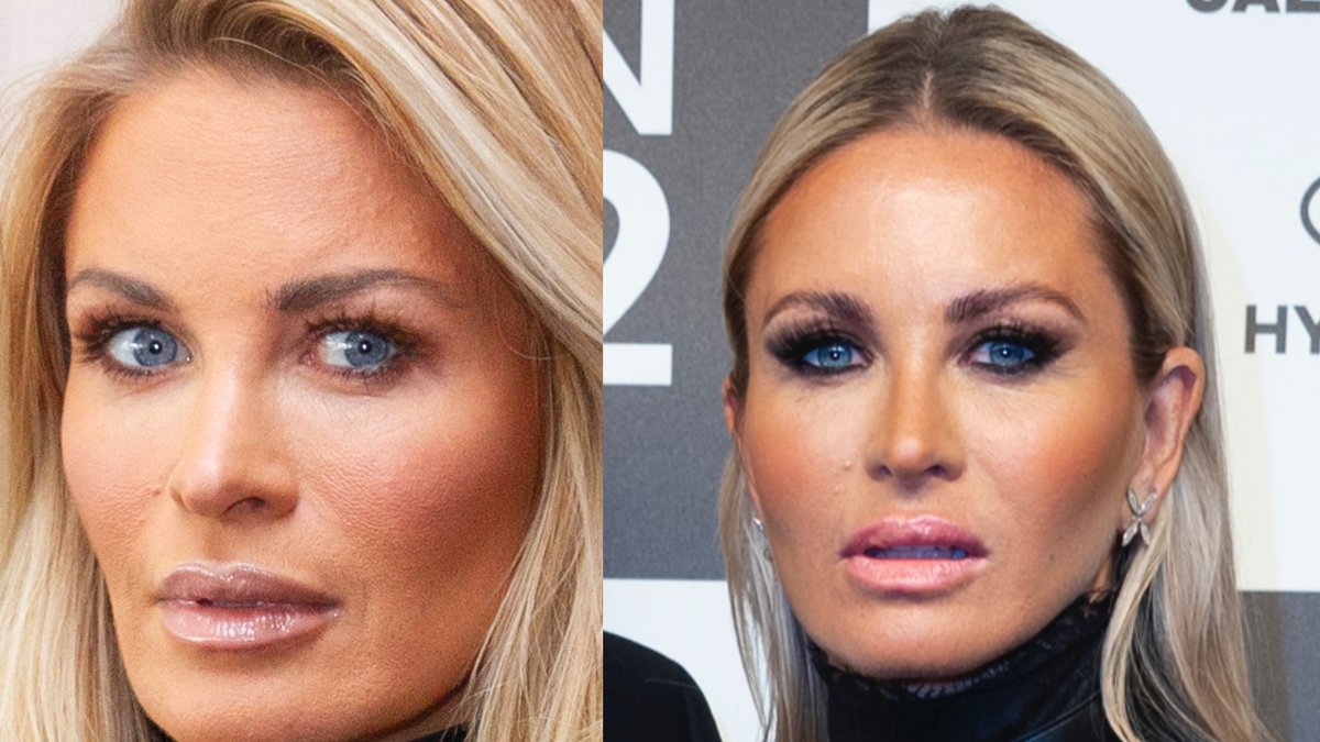 Carolina Gynning får ett utbrott