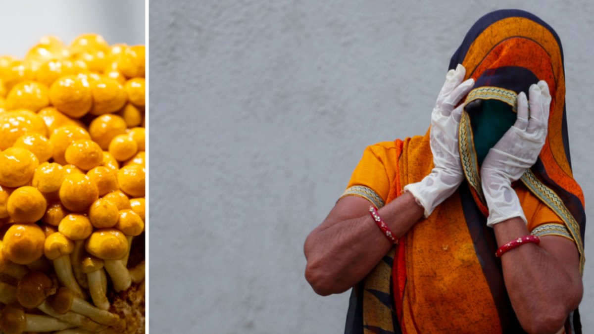 Allt fler drabbas av en svampinfektion efter corona i Indien.