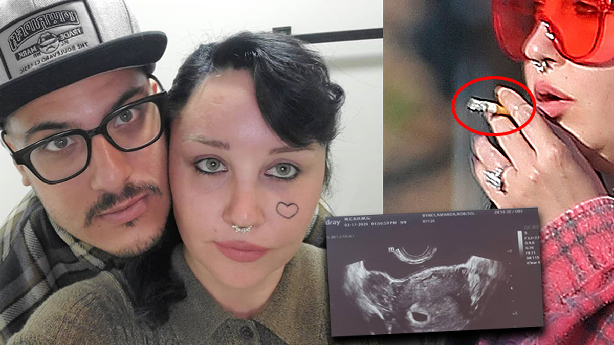 Amanda Bynes är gravid