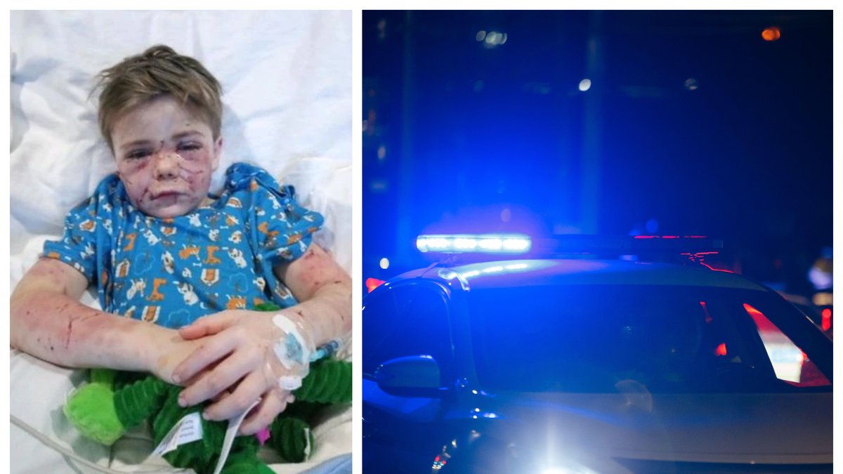 Conner Landers, 7, attackerades av en hund när han gick hem från skolan.