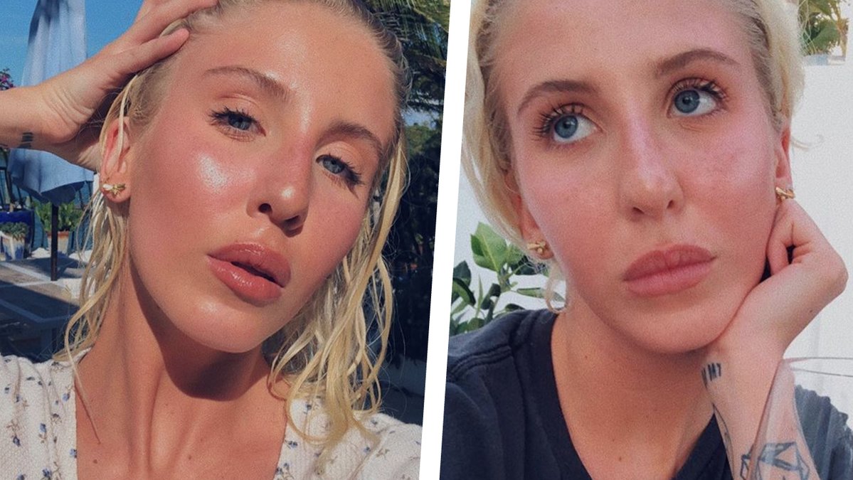 Peg-Parnevik-forsvarar-sin-botox