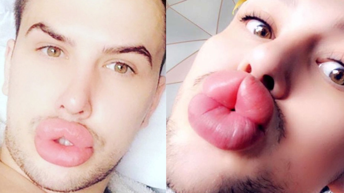 James Holt vill se ut som Kylie Jenner 