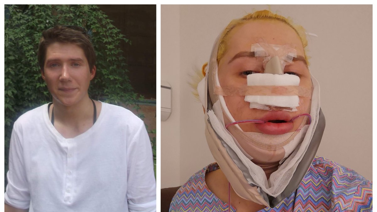 Den brittiske influencern Oli London, 31, kommer ut som icke-binär – och sydkorean.