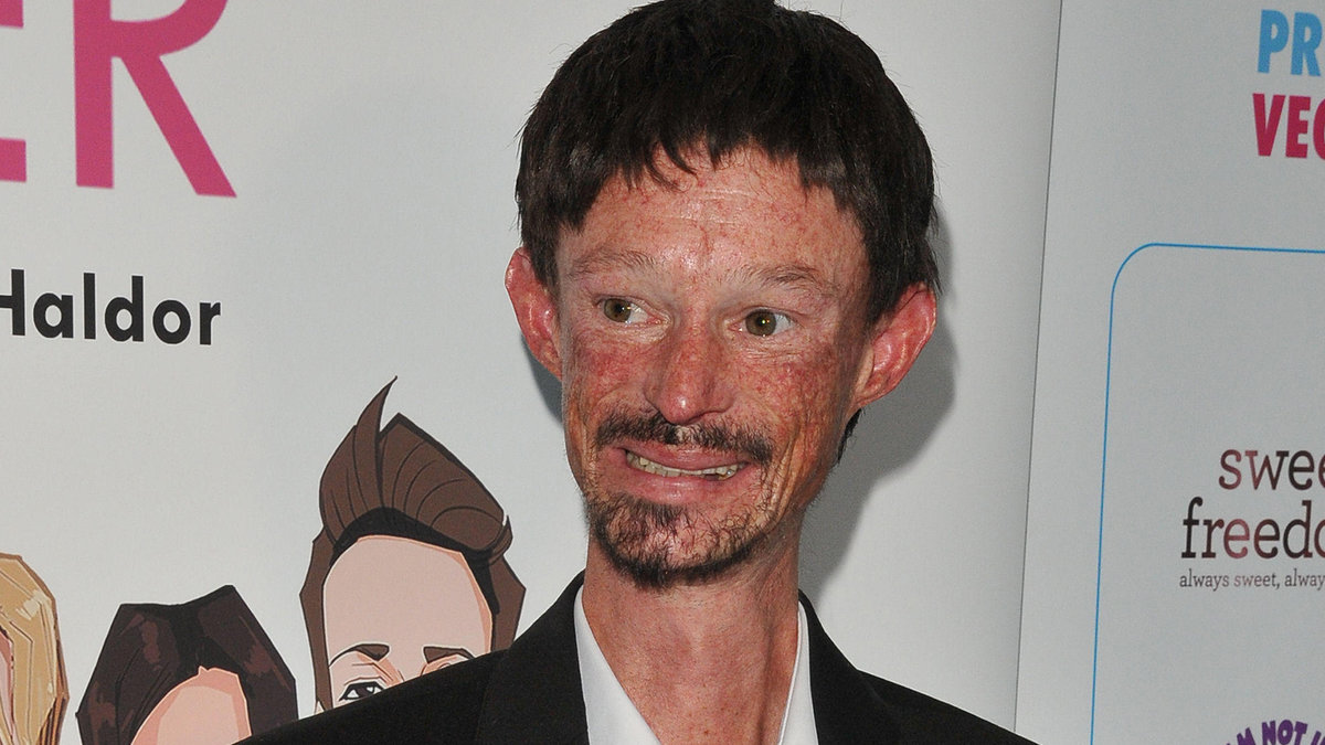 Darren Kent