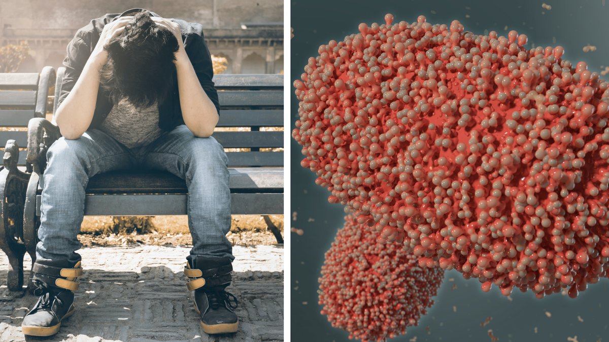 Efter resan: Fick covid, apkoppor och hiv samtidigt 