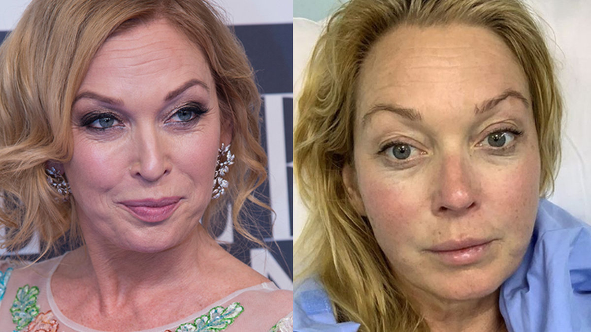Linda Lindorff akut opererad i Dubai