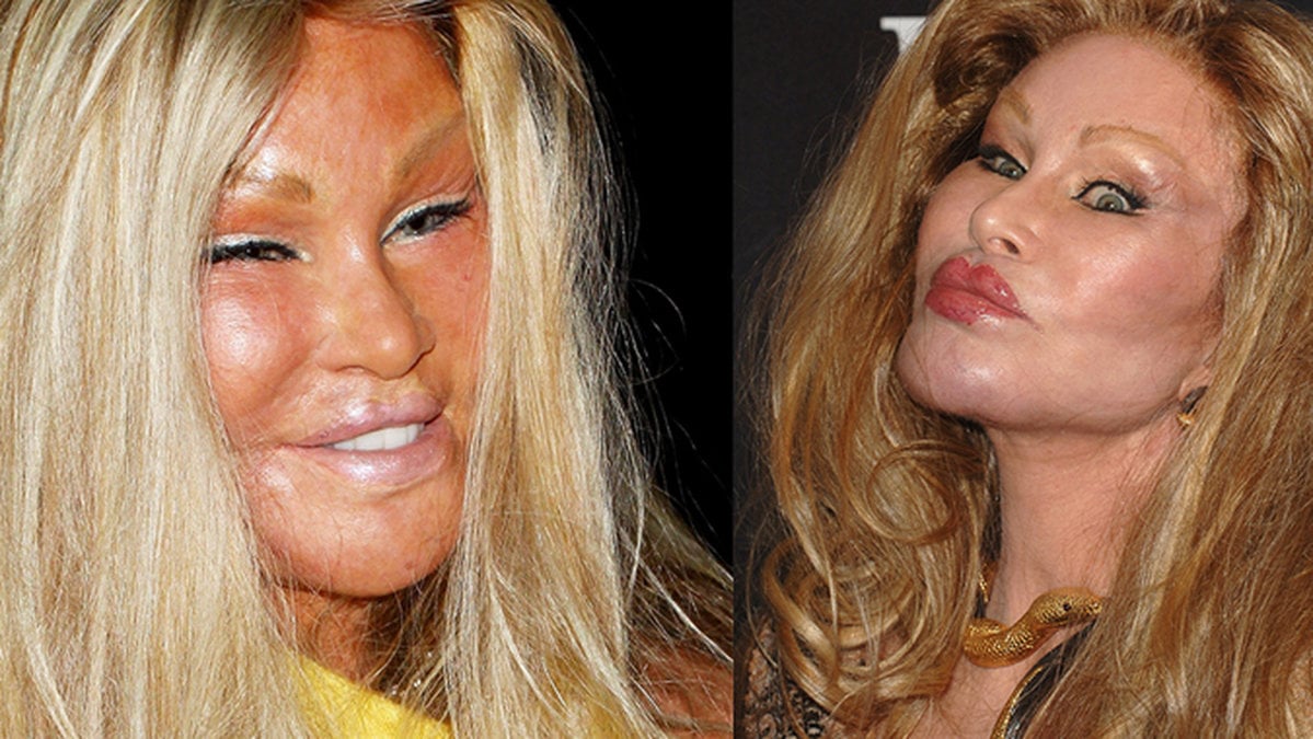 Jocelyn Wildenstein ryktas ha opererat sig för 40 miljoner kronor.