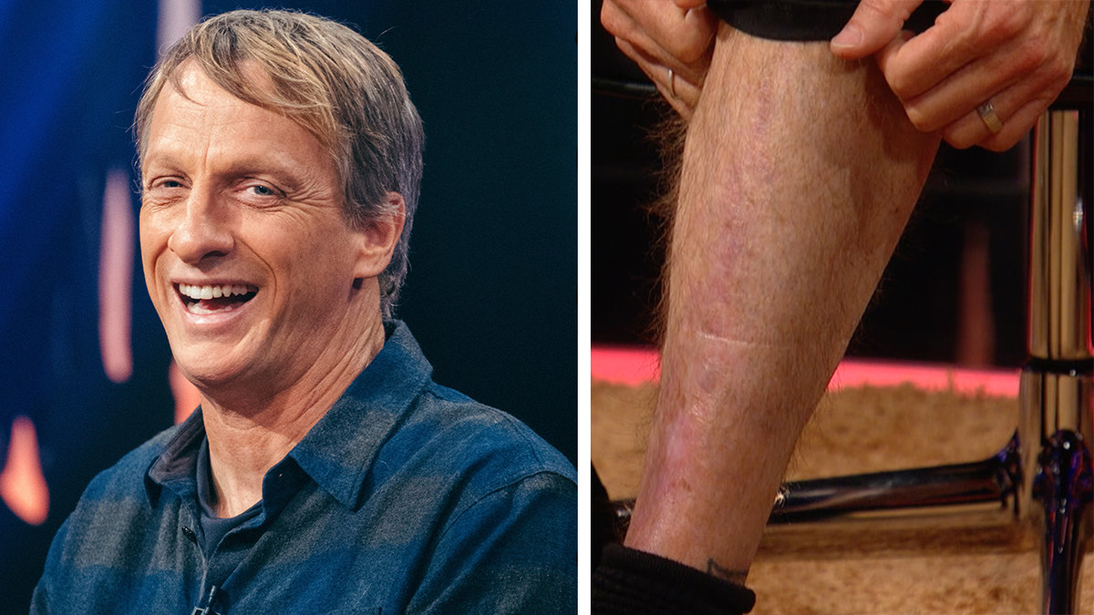Tony Hawk i Skavlan