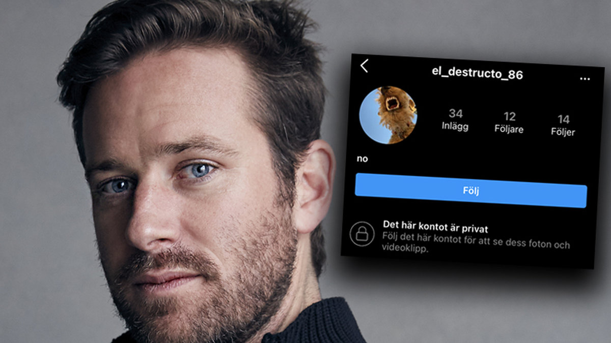 Armie Hammer