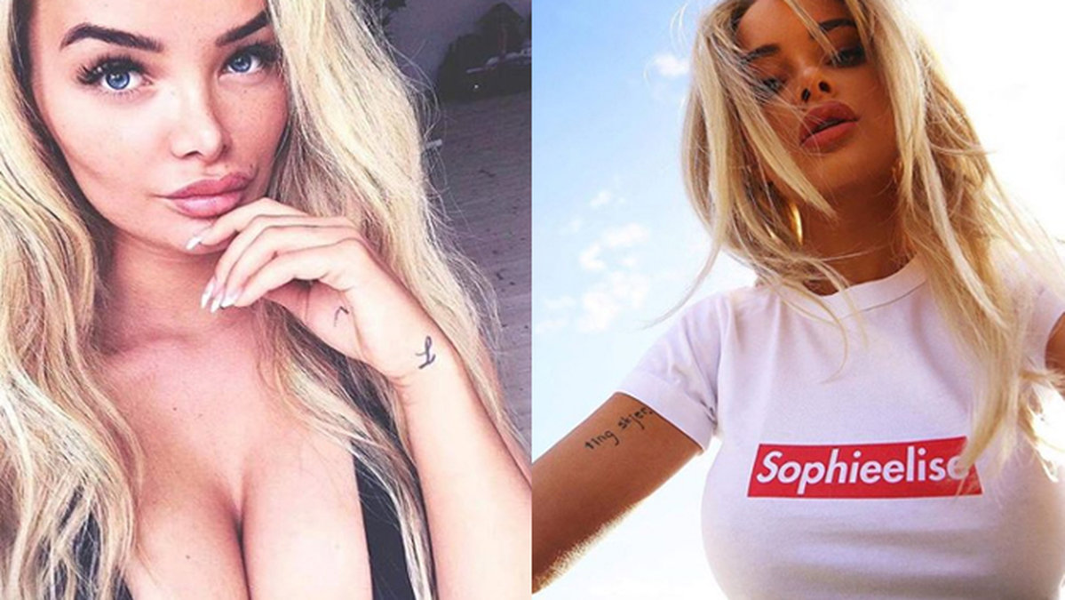 Den norska bloggerskan Sophie Elise har tagit ut sina fillers.