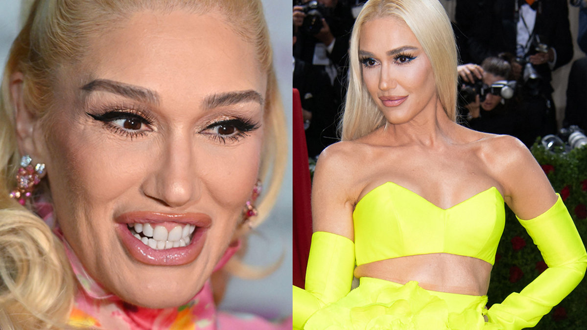 Gwen Stefani operationer