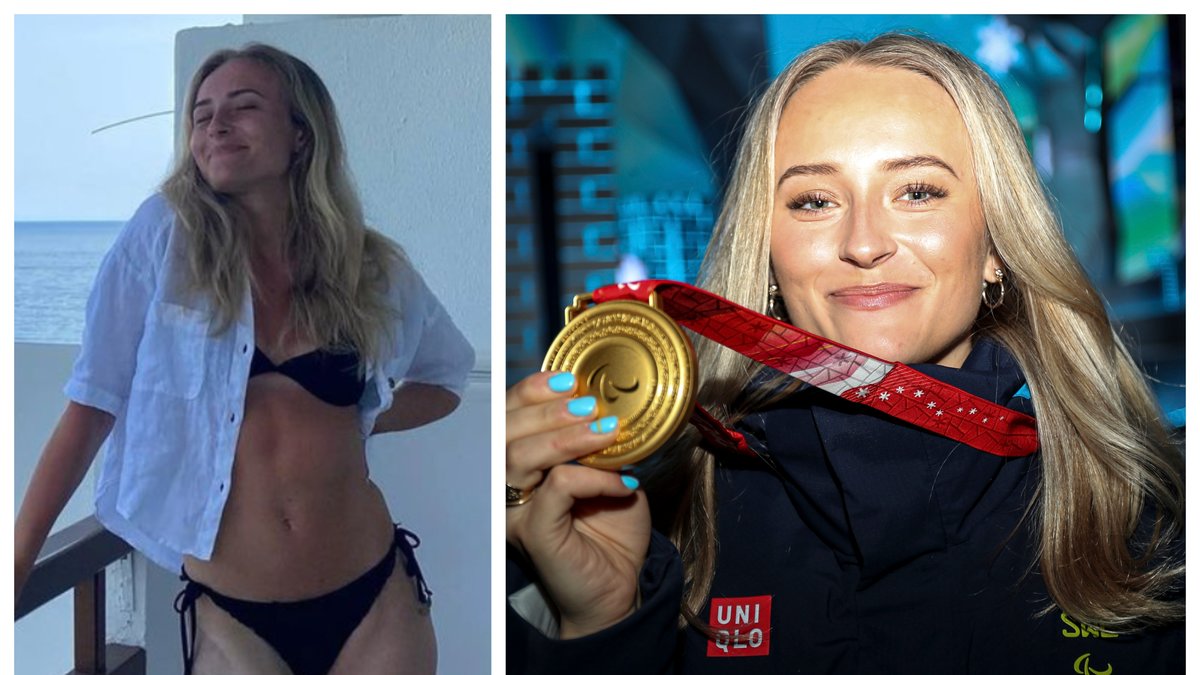 Ebba Årsjö visar upp sitt ben på Instagram.