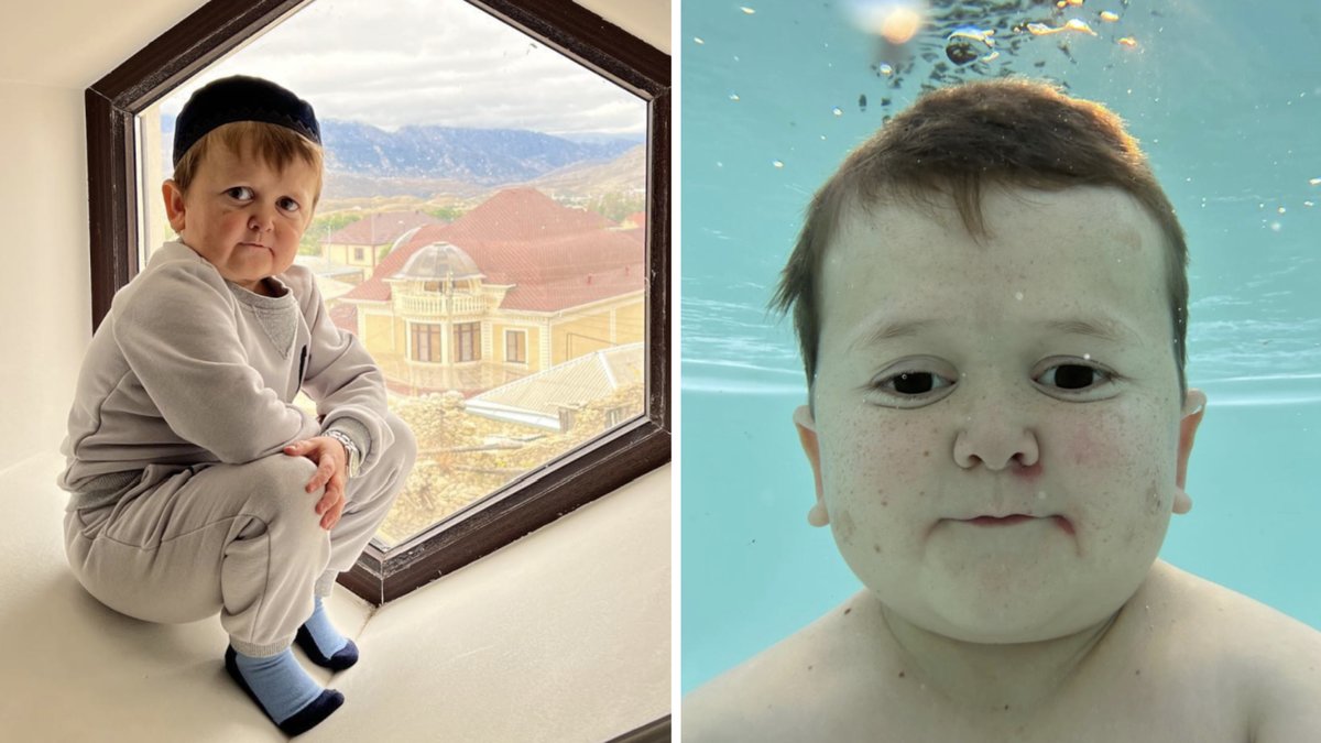 Hasbulla, 20, har blivit världskänd genom sina sociala medier