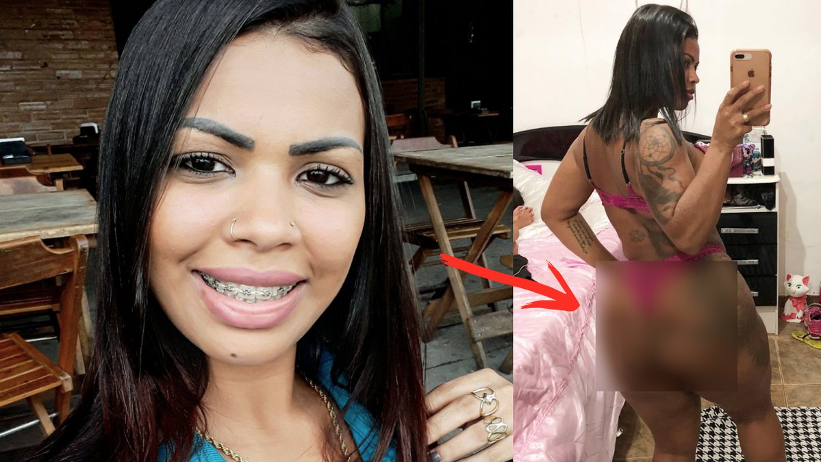 Angela-Pedrosa-holl-pa-att-do-efter-rumpforstoringen