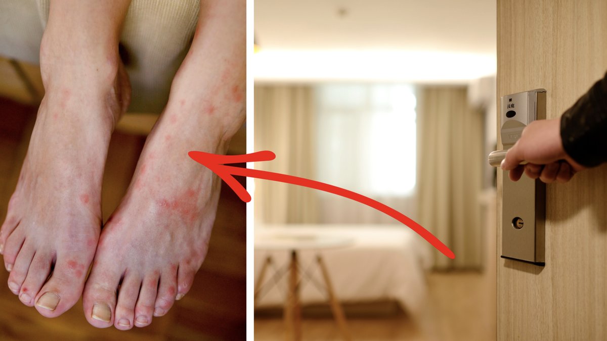 Många får med sig vägglöss hem från utlandsresan.