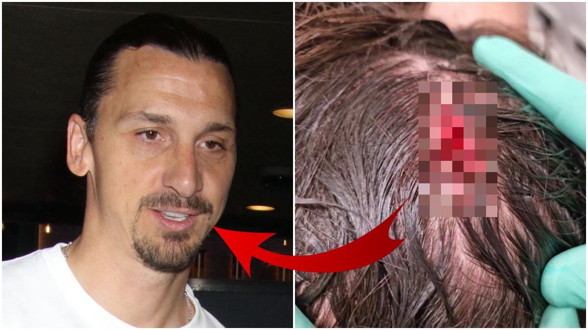 Zlatan Ibrahimovic