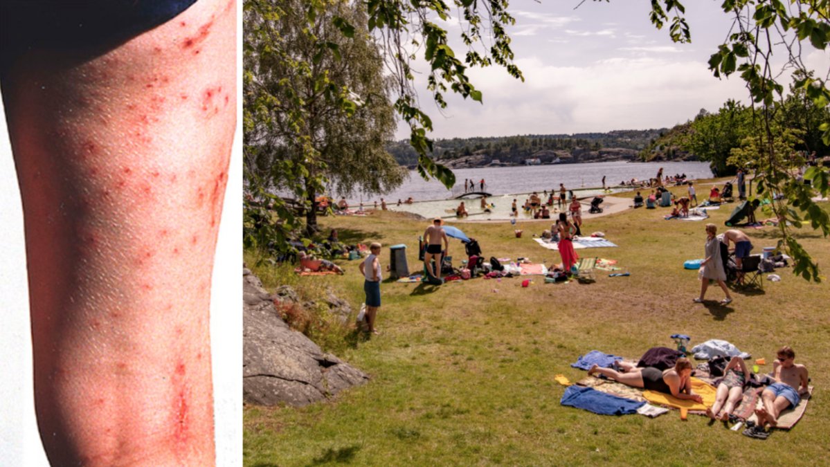 Utslag och genrebild på badplats.