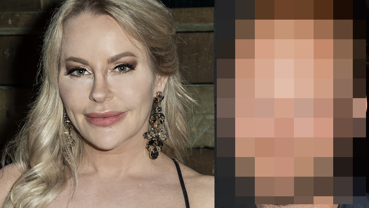 Åsa Vesterlund och kirurgen