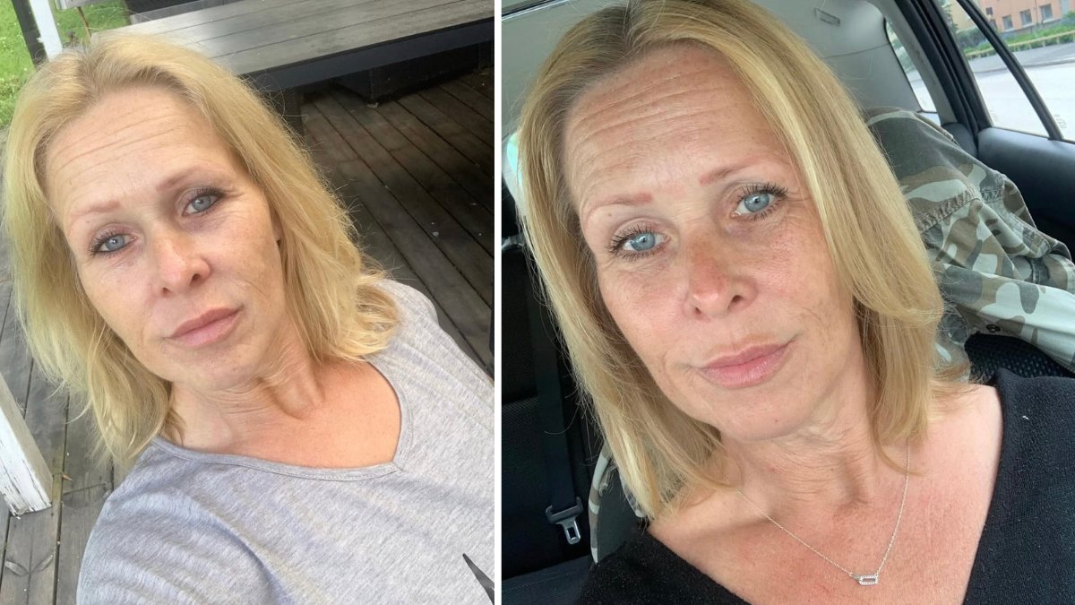 Mirka Norrström lider av utmattningsdepression