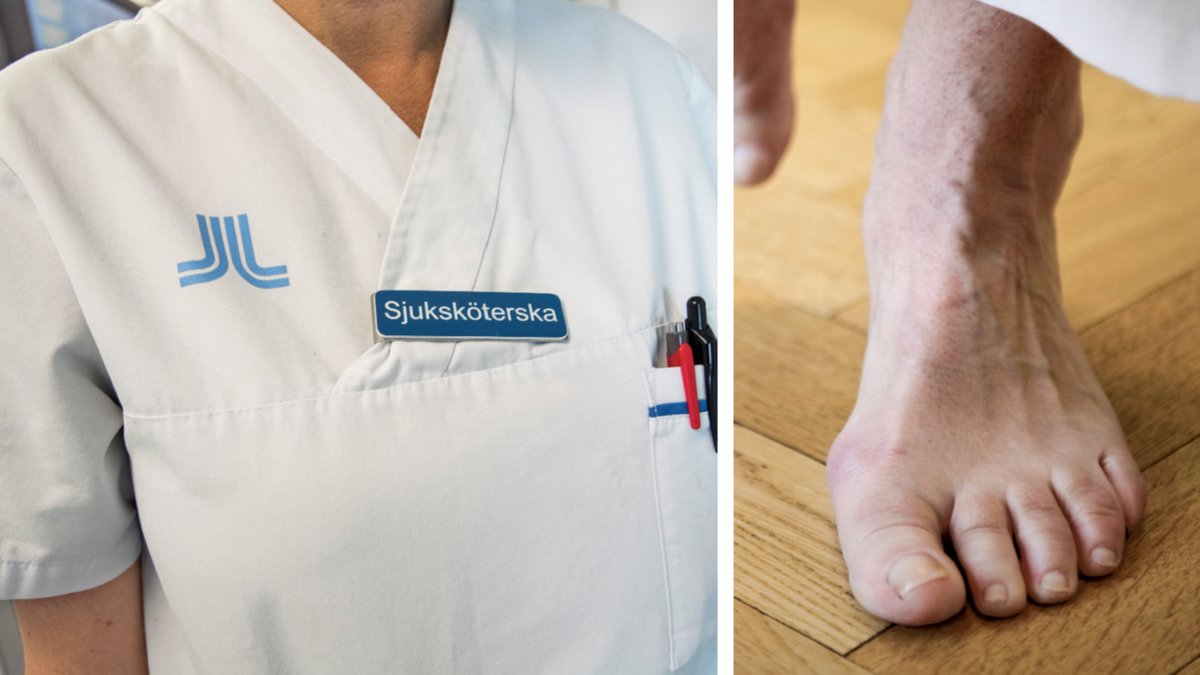 En sjuksköterska klippte av en man tån.