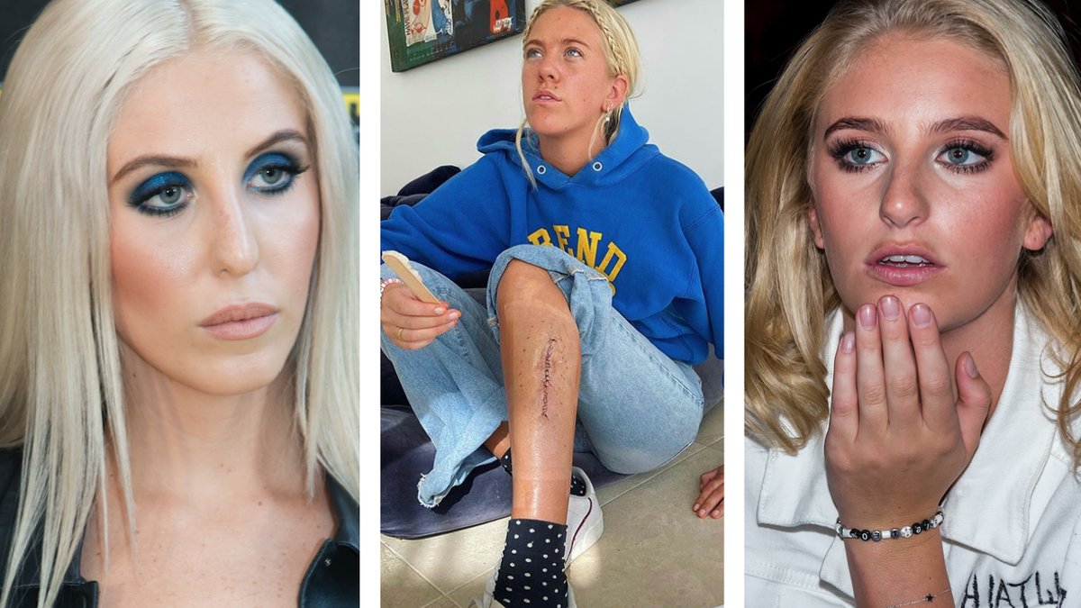 Peg-och-Penny-Parnevik-om-Phillipas-cancer