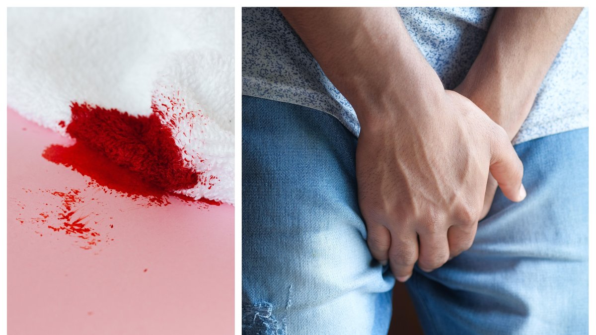 Att ha för kort penissträng är inte ovanligt.