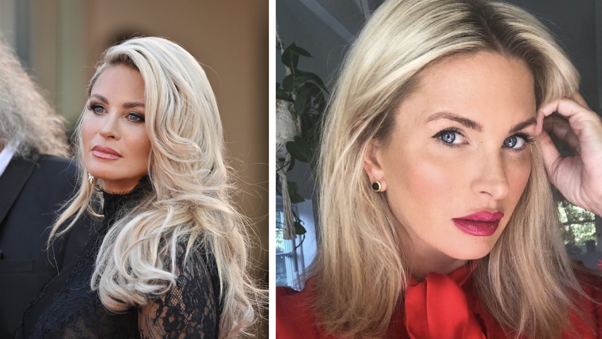 Carolina Gynning efter olyckan i hemmet: Jävligt allvarligt