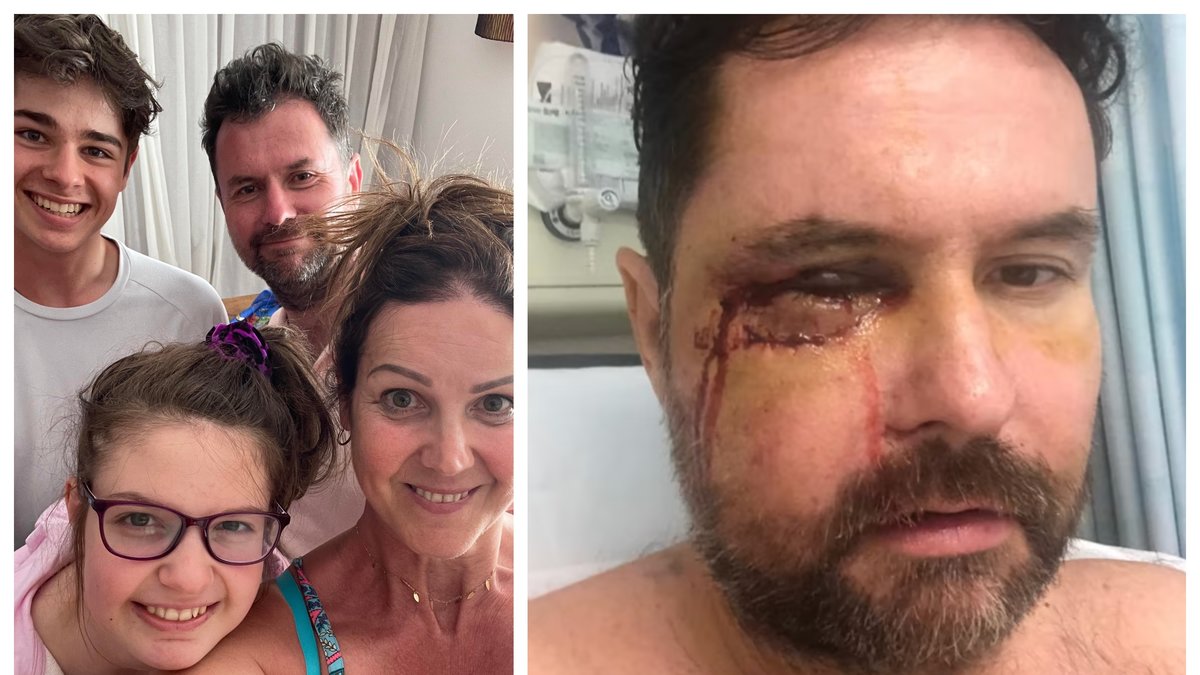 Shaun Mollon, 49, misshandlades svårt i en oprovocerad attack.