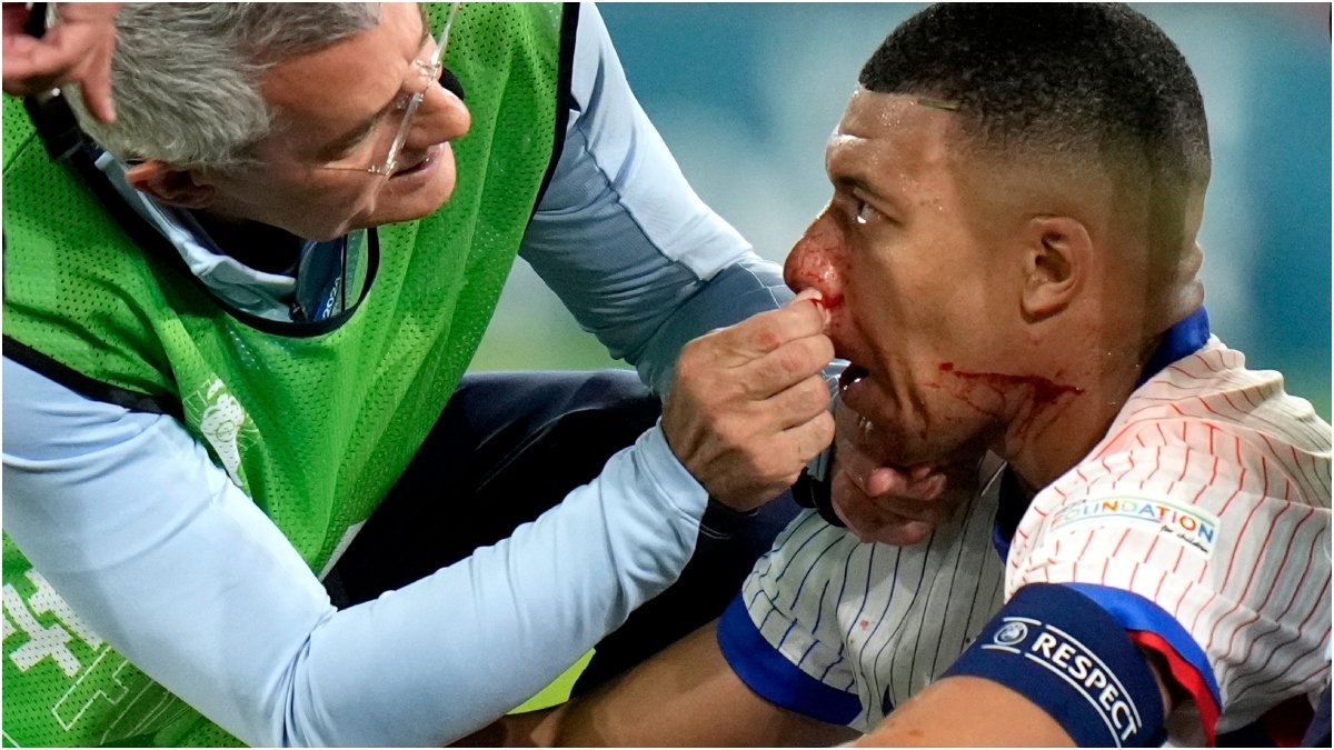 Kylian Mbappe bröt näsan i EM--premiären.