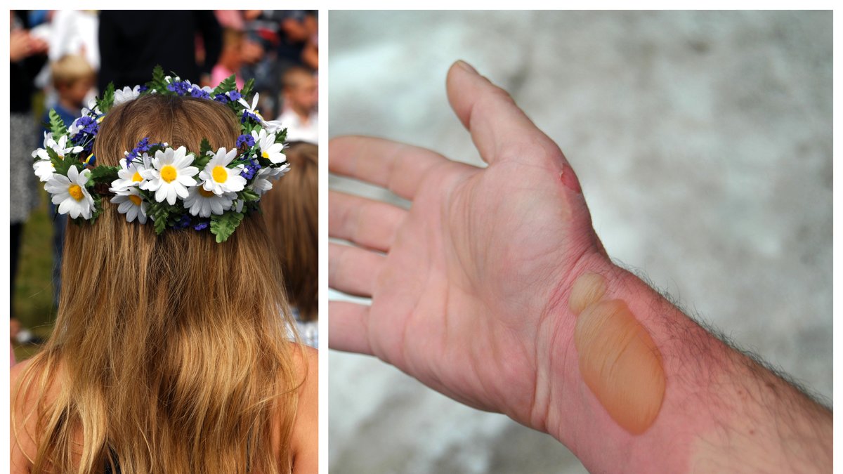 Björnloka kan ge brännblåsor. Bilderna är genrebilder.