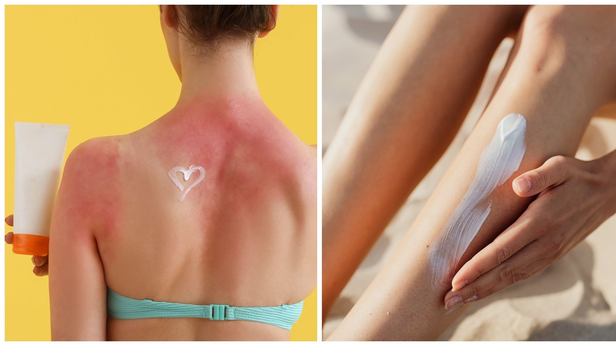 Misstagen många gör i solen enligt läkaren: Det finns alltid risk för...