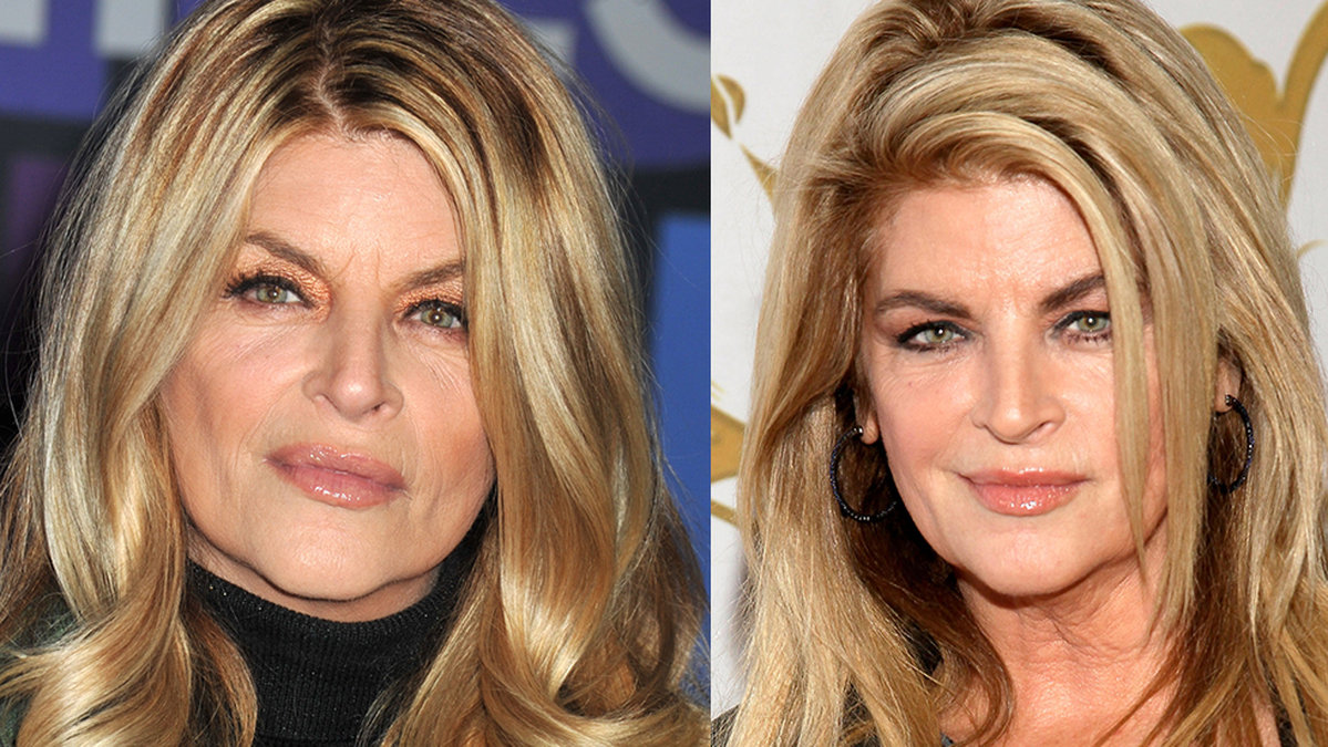 Kirstie Alley är död