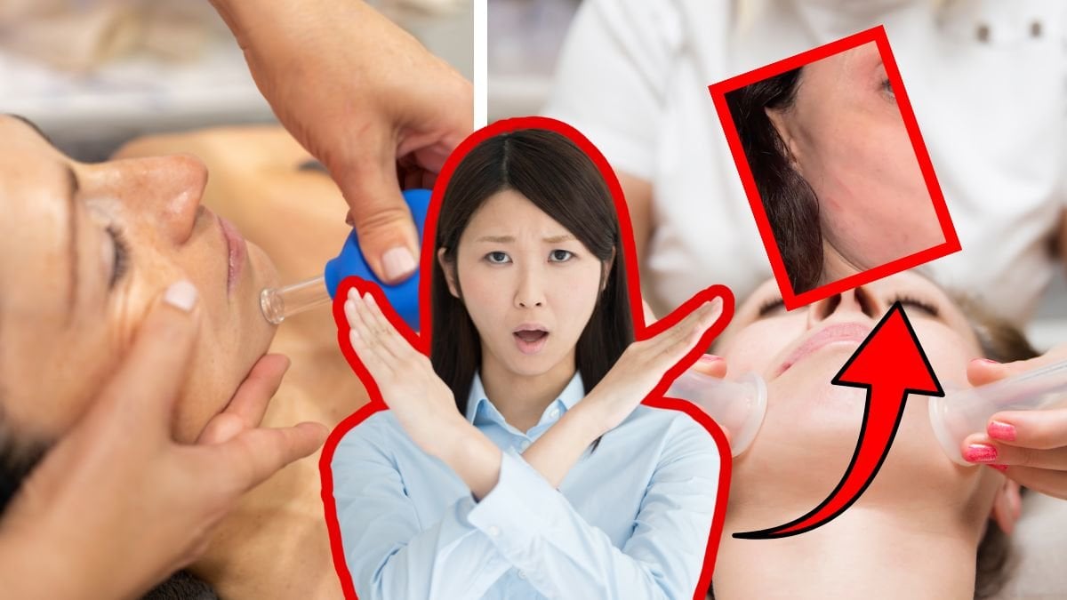 Ansikts-cupping vänster och höger. En kvinna som håller armarna som ett x i mitten. Bild på Bethenny Frankles sår efter olyckan till höger.