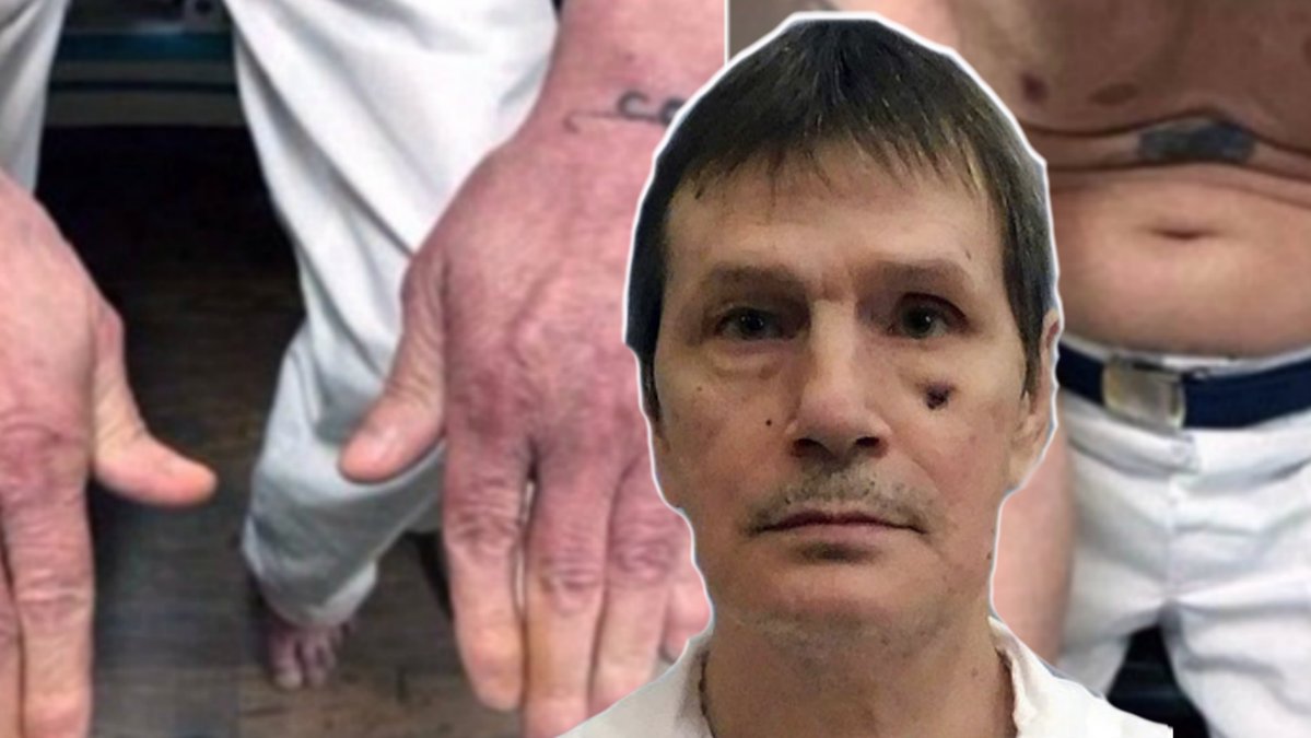 Personalen hittade inga vener att föra in den giftiga injektionen i Doyle Lee hamm som var dömd till döden