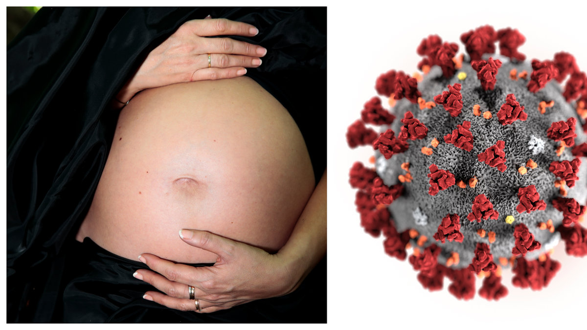 Gravid kvinna intensivvårdas.