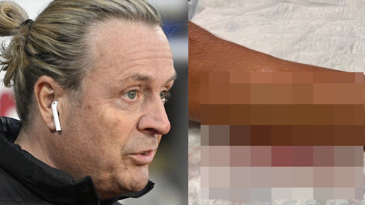 Runar Sögaards son Presley skjuten i benet