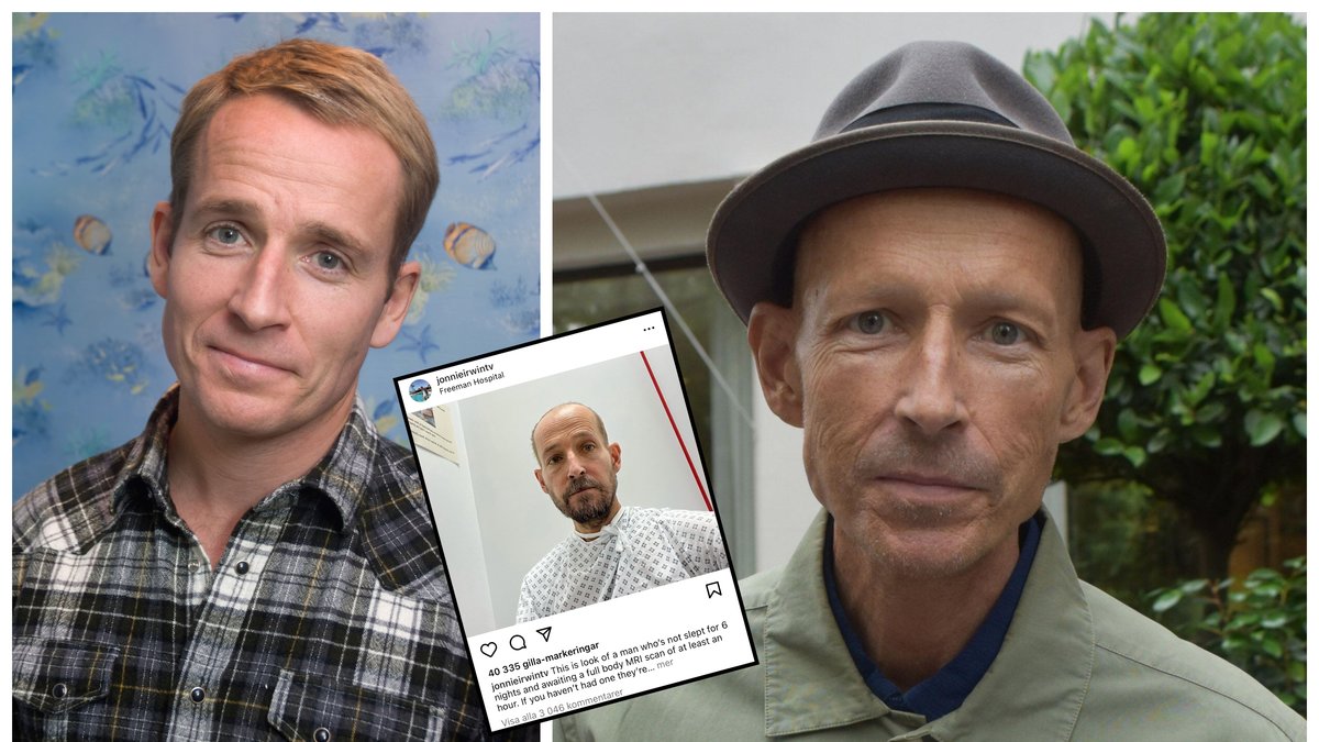 Jonnie Irwin fick diagnosen lungcancer i september 2020.