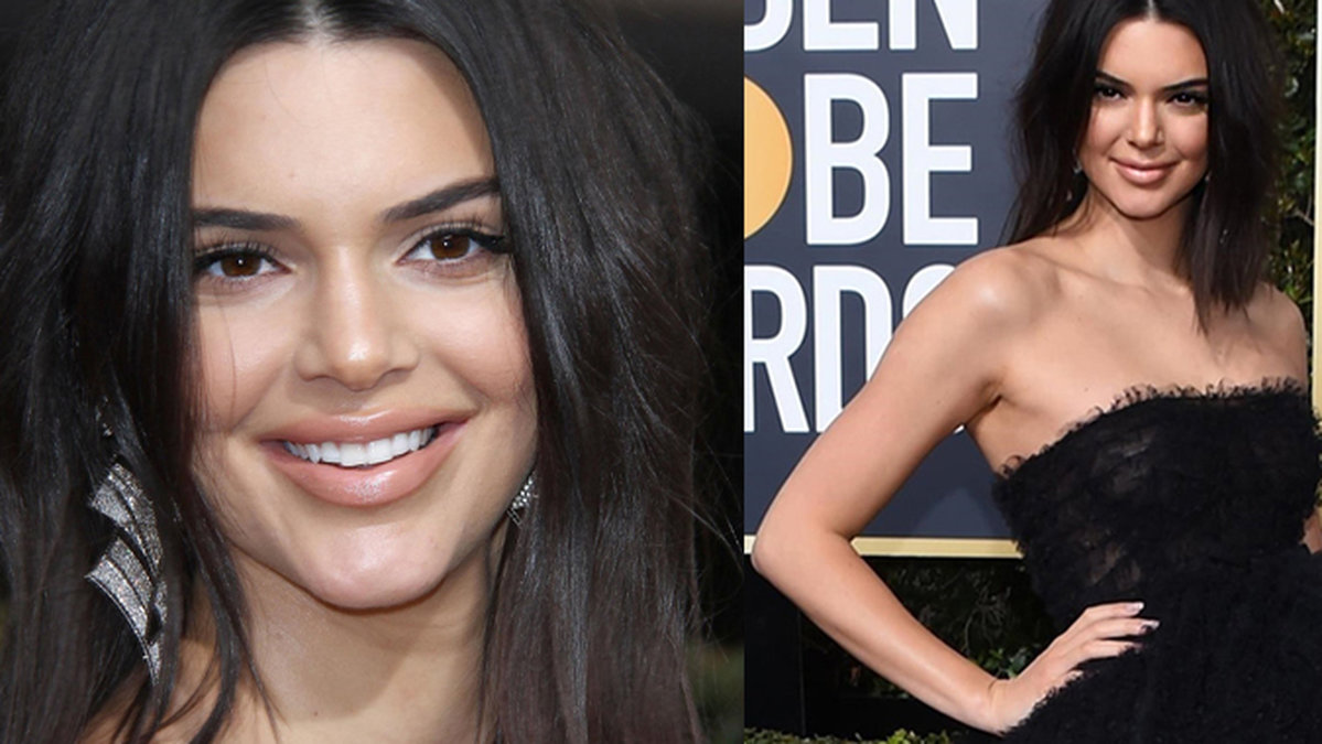 Kendall Jenner chockade alla med sina nya läppar. 