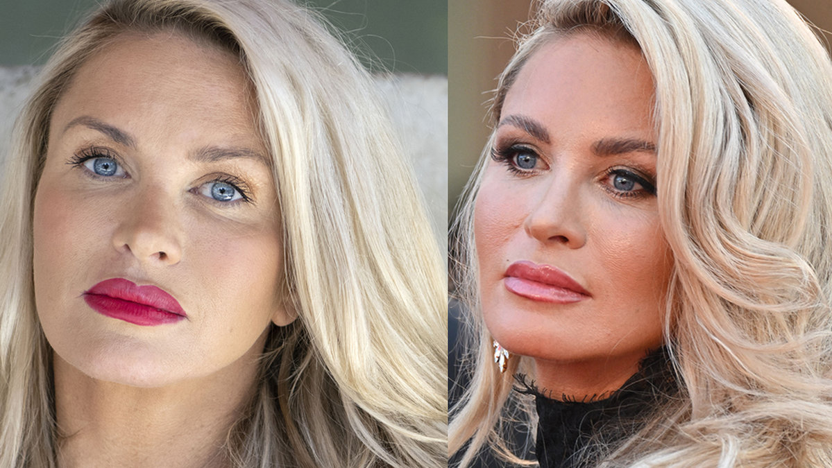 Carolina Gynning möttes av kritik efter att hon opererat brösten.
