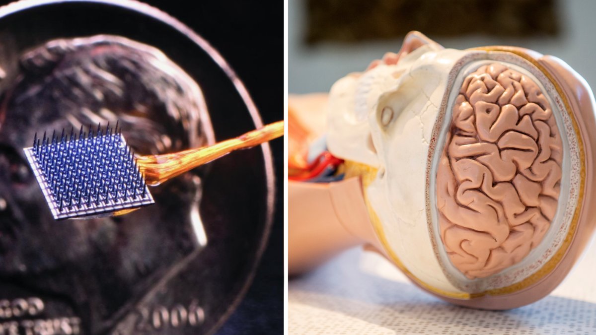 Bild på BCI-implantat. Genrebild på medicinsk docka.