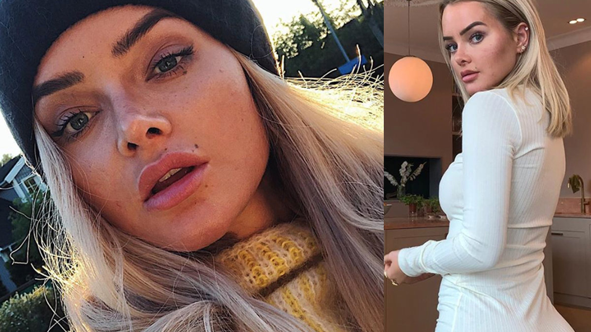 Sophie Elise om operationen