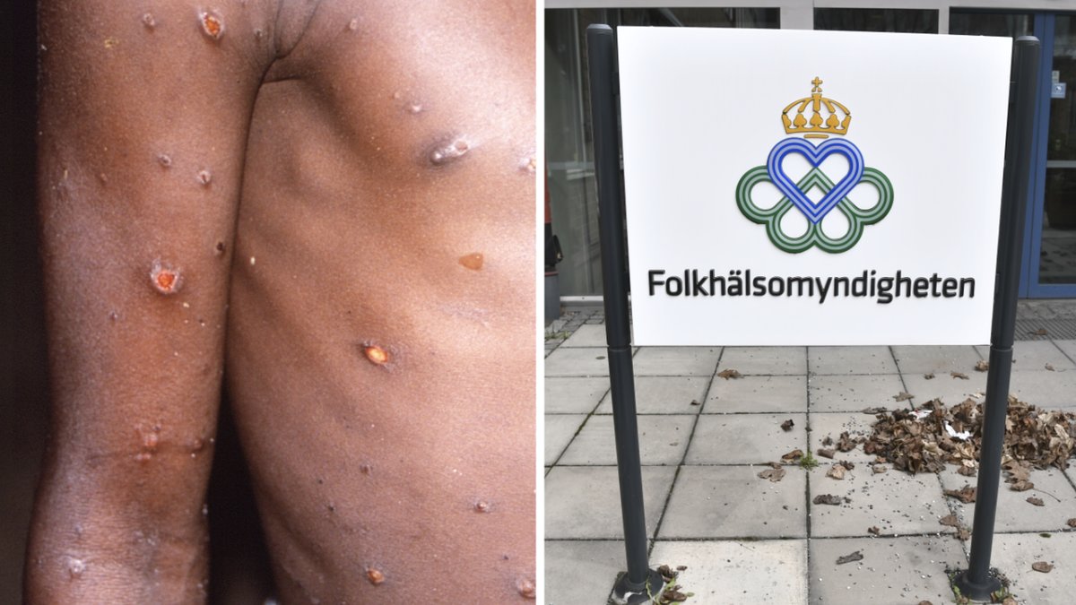 Nytt fall av apkoppor i Sverige. 