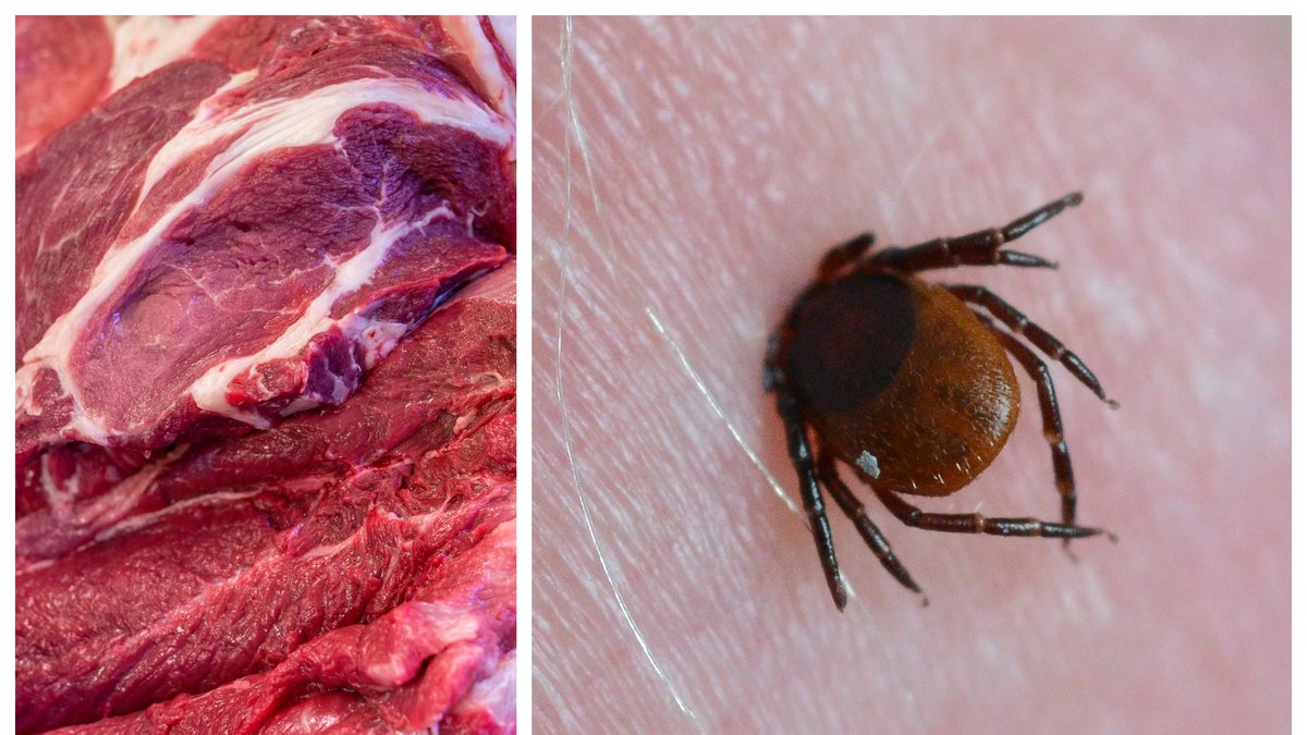 Fästingbett kan orsaka köttallergi.