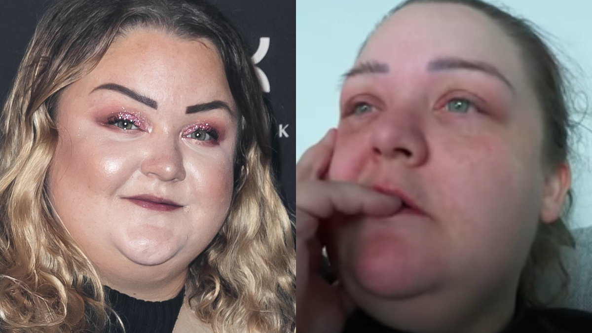 Felicia Bergströms gynekolog är polisanmäld.