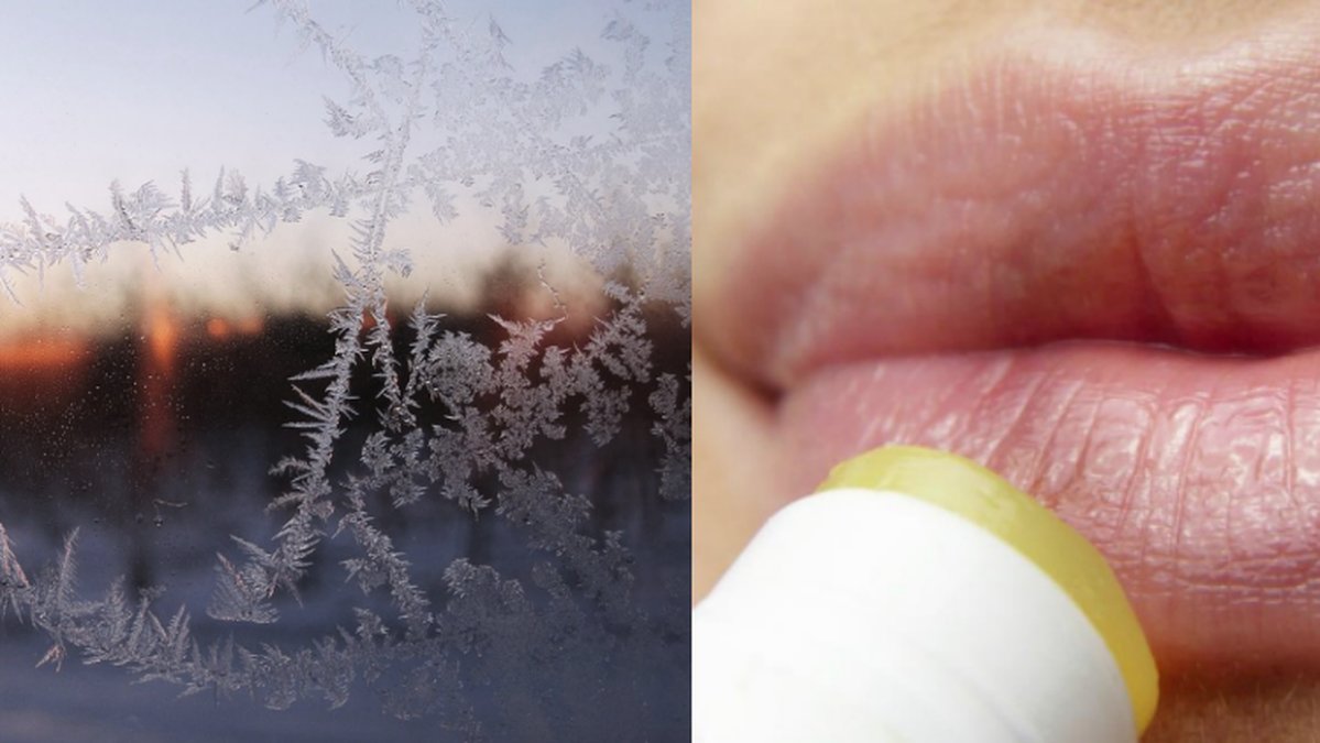 läppbalsam på torra läppar, frost