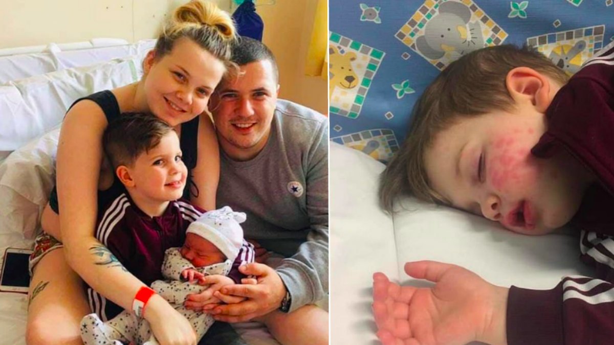 Hayleys son drabbades av herpes.