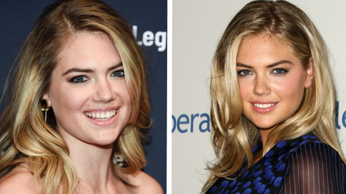 Kate Upton